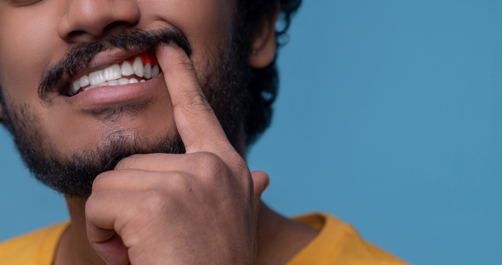 Pulpite: descubra os melhores métodos de tratar um dente inflamado